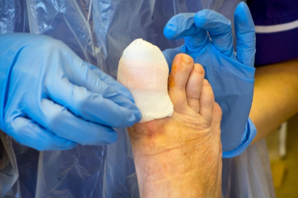 treatment of ingrown toenail