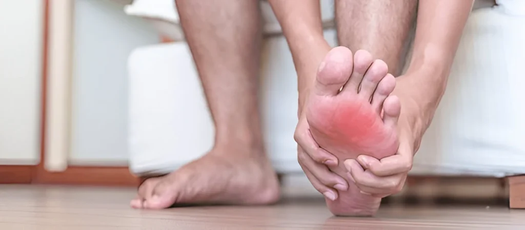 Plantar Fasciitis