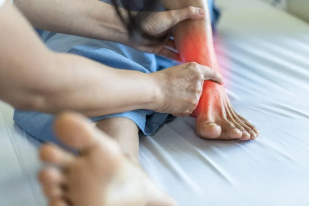 Arthrities