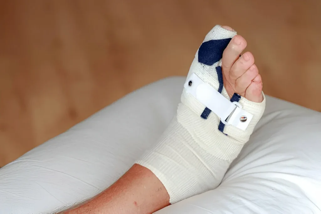 What Can I Expect During the Recovery Period?