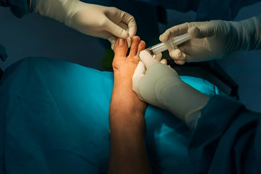 How Experienced Are You with Bunion Surgeries?