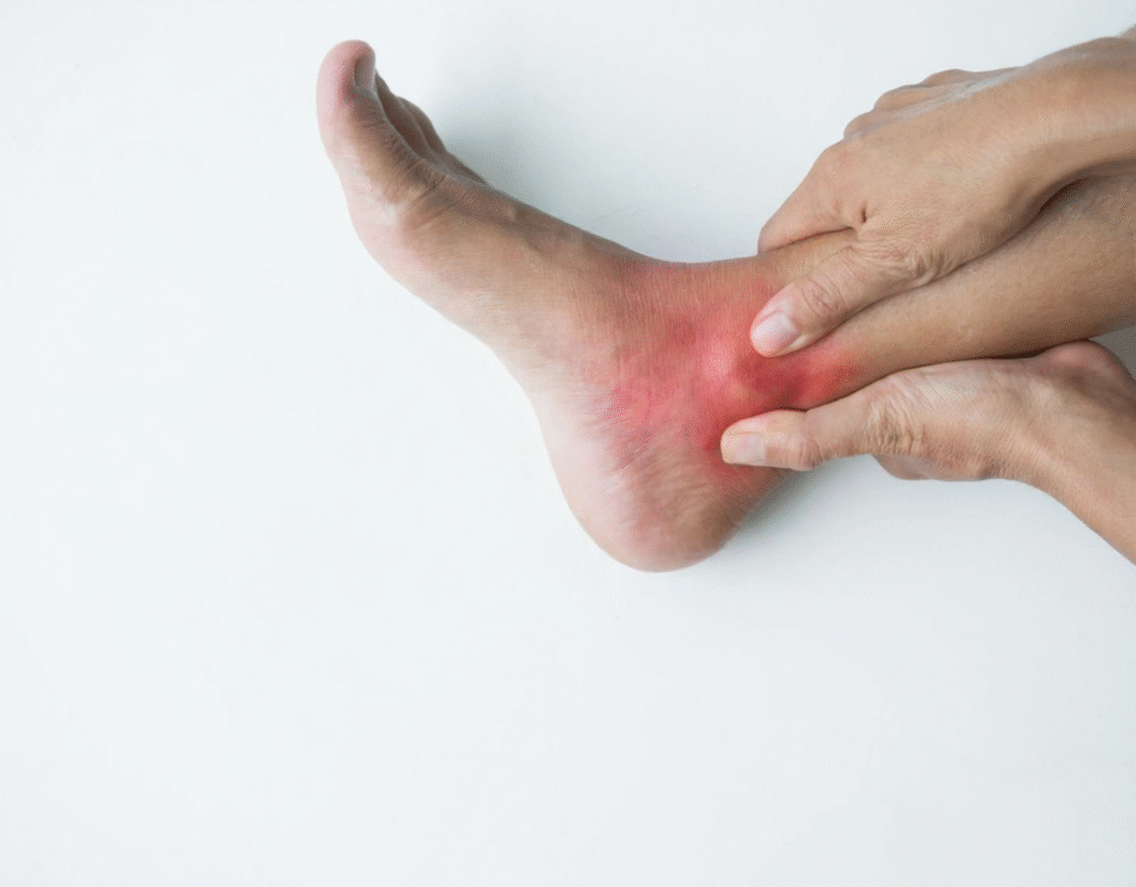 Ankle Sprain Pain