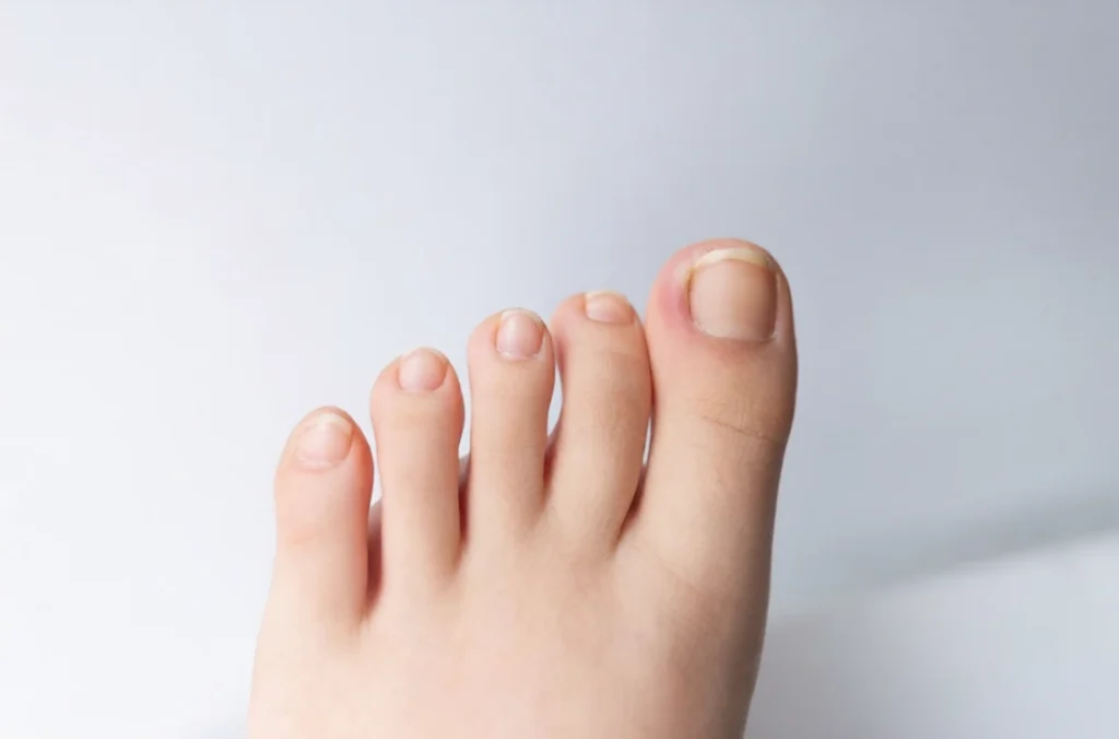 toenail nail