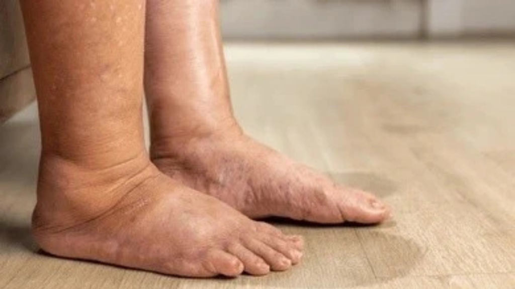 Diabetic foot care