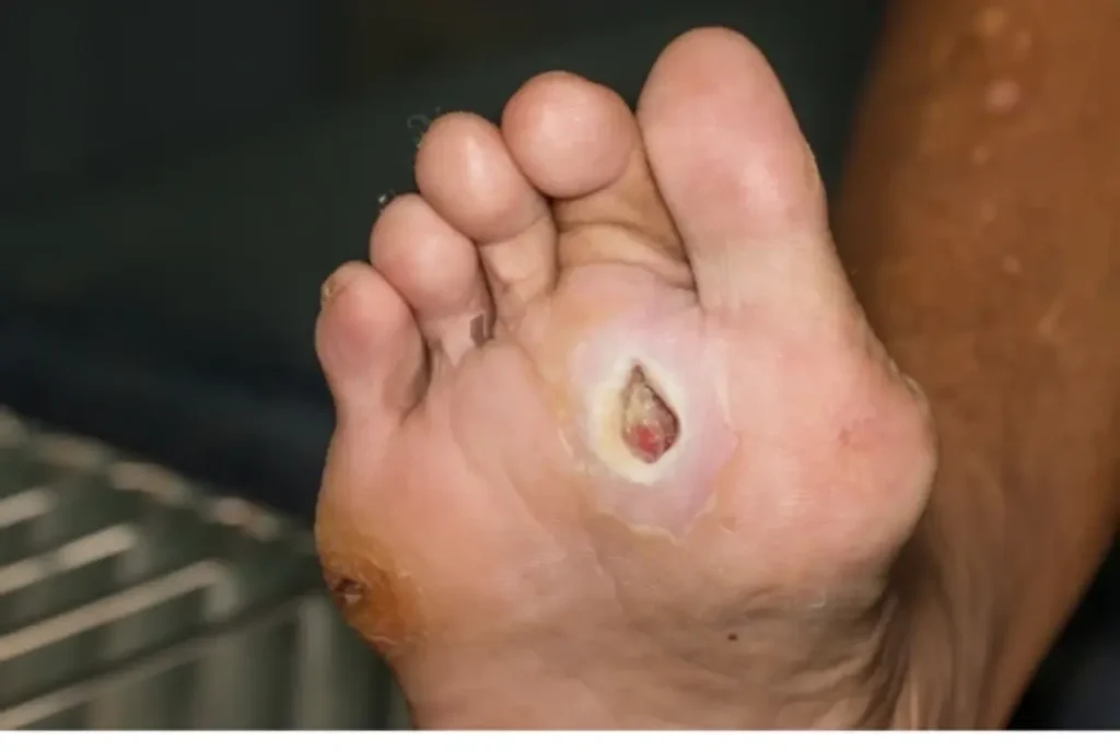 diabetic foot care services