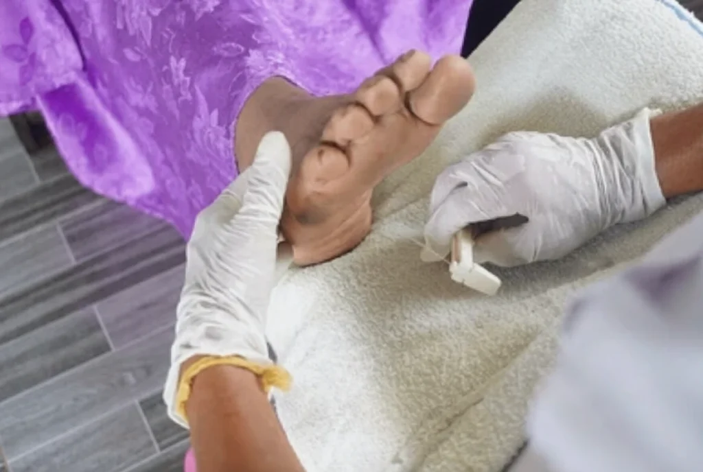 diabetic foot pain relief
