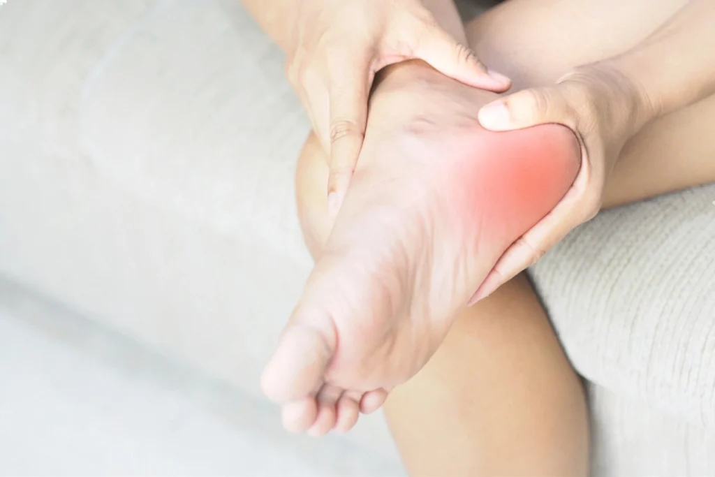 Plantar Fasciitis Home Treatment