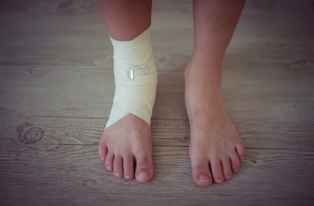 bone replacement